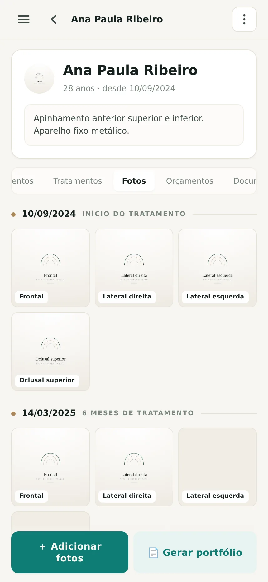 Linha do tempo de fotos clínicas de uma paciente no Odenty Pro, organizadas por data de tratamento